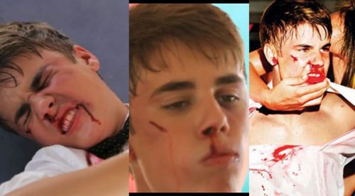 ¡Mira la paliza que le dieron a Justin Bieber!