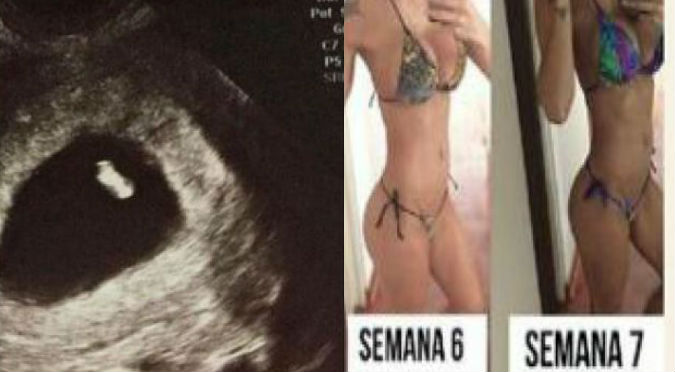 ¡Lamentable! Exchica reality contó que perdió a su bebé